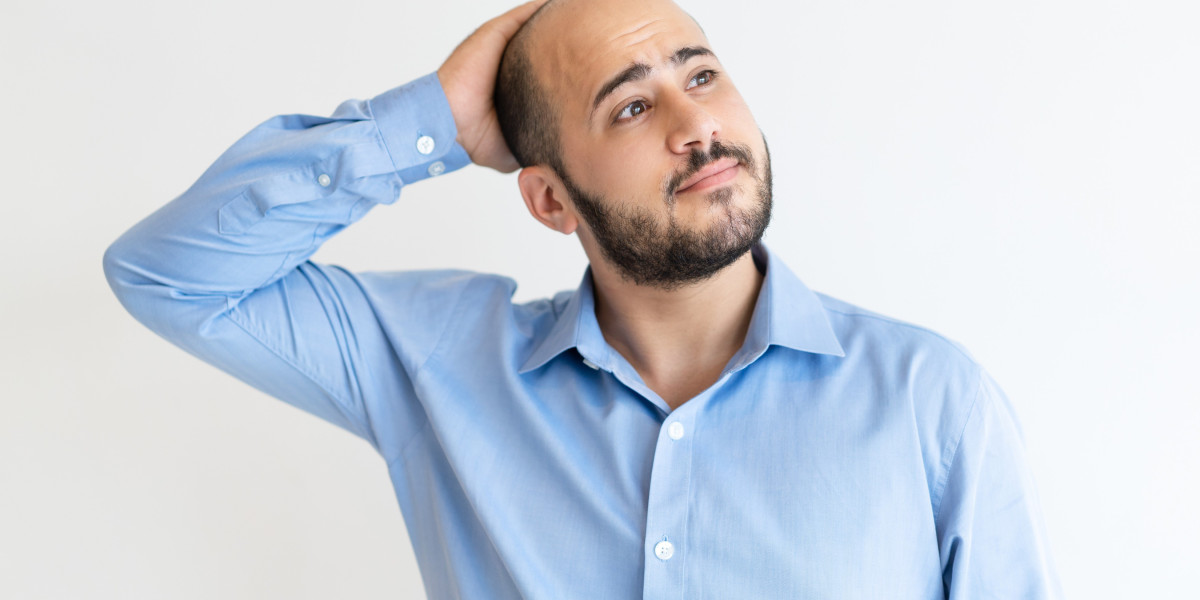 Best Finasteride Alternatives in 2025: Safer Hair Loss Solutions